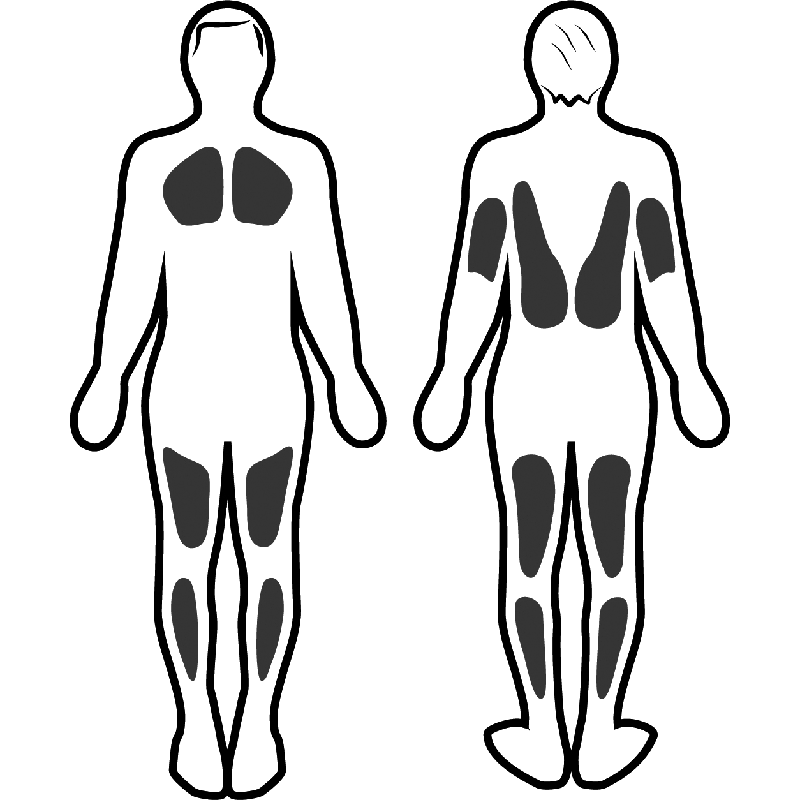 Muskuläre Stimulation