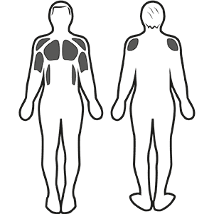 Muskuläre Stimulation